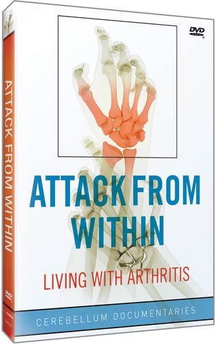Attack From Within: Living With Arthritis [DVD] [Import](中古品)